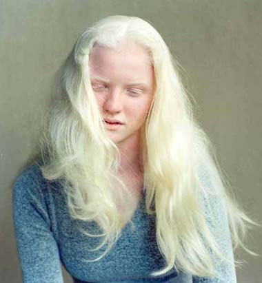 девушка альбинос